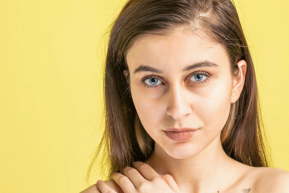 How To Deal With Dark Circles Under Your Eyes